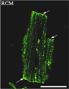 Myocyte